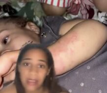 Madre denuncia maltratos de guardería a su hija de 11 meses