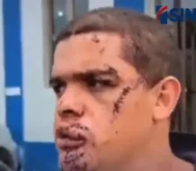 Joven resulta herido Tras pelea con un amigo en Jarabacoa: “Nosotros somos como hermanos”