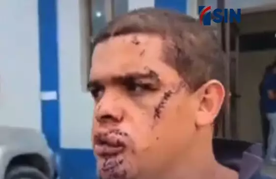 Joven resulta herido Tras pelea con un amigo en Jarabacoa: “Nosotros somos como hermanos”