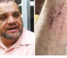 CMD solicita al director de la Policía aclarar agresión al doctor Hipólito Medina