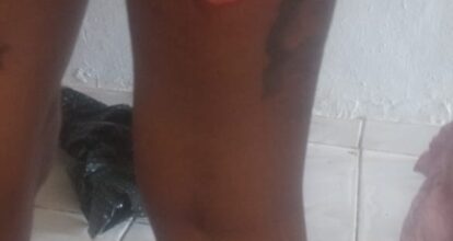 Hombre hiere a su expareja a machetazos en SDO
