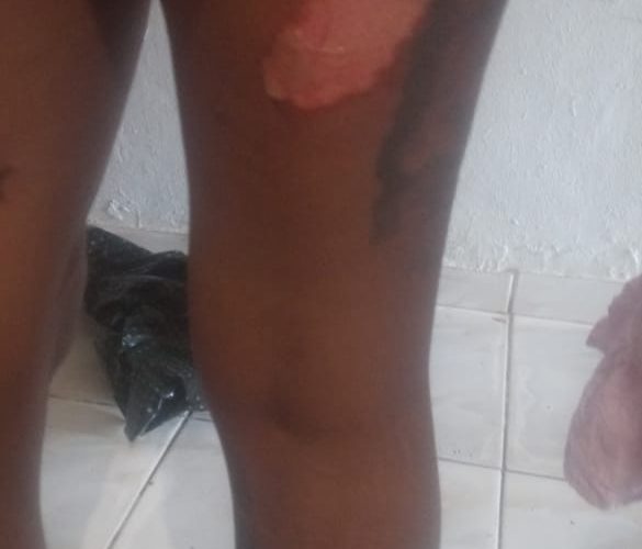 Hombre hiere a su expareja a machetazos en SDO