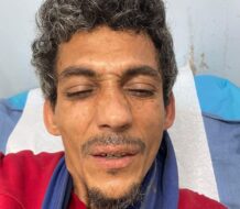 Hombre resulta herido durante intervención en supuesto punto de drogas en Esperanza