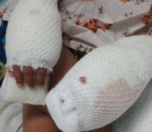 Dictan tres meses de preventiva a madre acusada de quemar a su hijo de 4 años 
