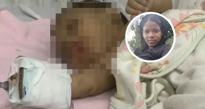 Bebé agredida por su madre en Miches ya está en casa bajo custodia de su padre, según Conani