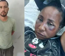 Detienen a hombre acusado de agredir brutalmente a su pareja en Puerto Plata