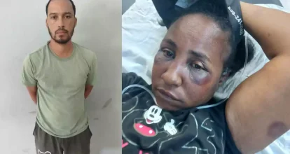 Detienen a hombre acusado de agredir brutalmente a su pareja en Puerto Plata