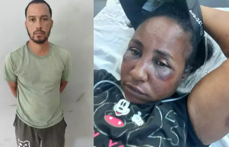 Detienen a hombre acusado de agredir brutalmente a su pareja en Puerto Plata