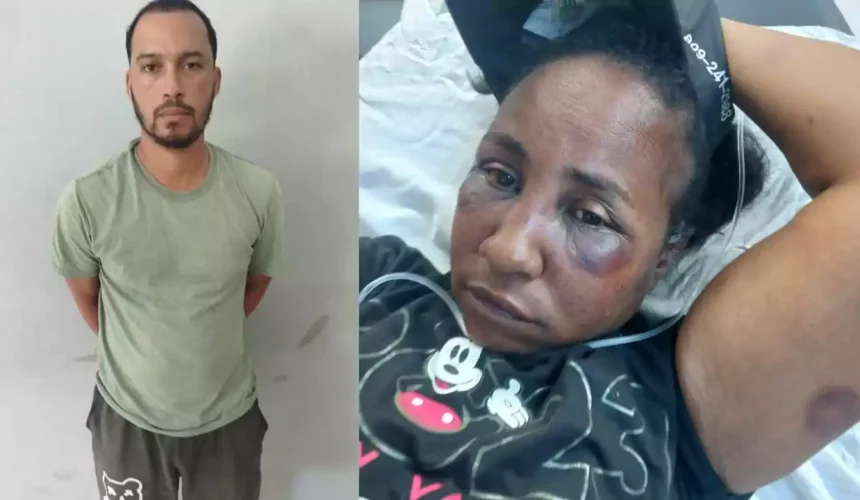 Detienen a hombre acusado de agredir brutalmente a su pareja en Puerto Plata