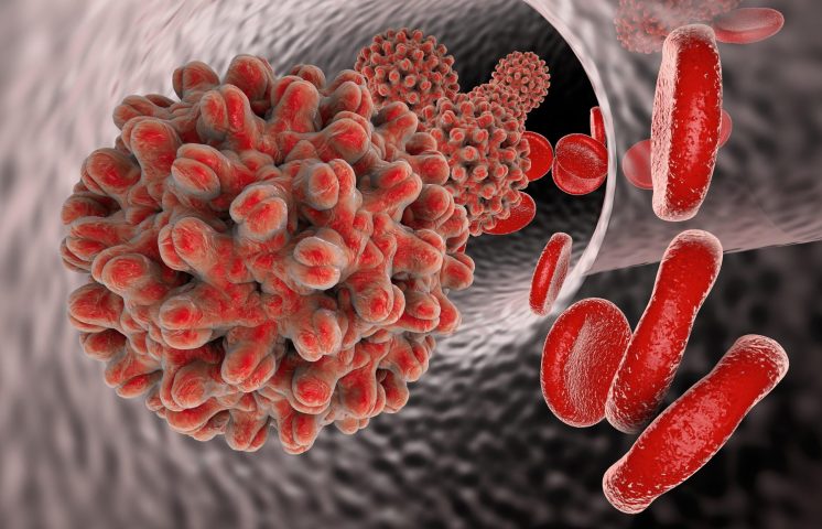 Más de 2 mil casos de hepatitis virales se reportan en RD