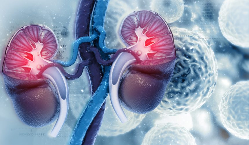 En el país se diagnostican 152 casos de cáncer renal, según estudio