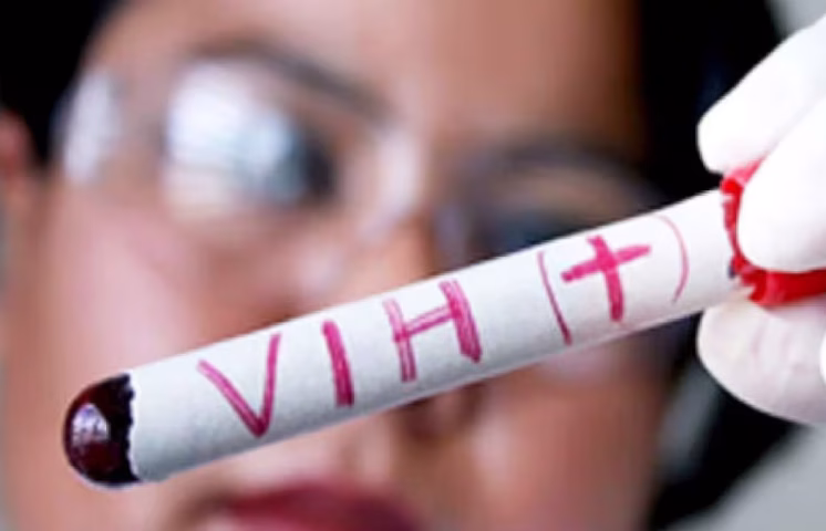 ONUSIDA dice más de un millón de personas en el mundo contrajeron VIH en 2024