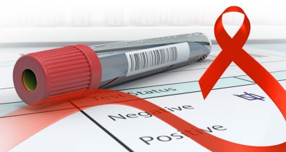 Conavihsida dice RD bajó un 13 % en nuevas infecciones por VIH en 2024