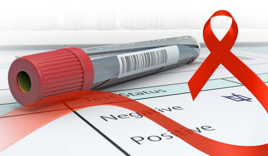 Conavihsida dice RD bajó un 13 % en nuevas infecciones por VIH en 2024