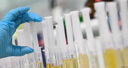 Empresa busca transformar la orina humana en fertilizante