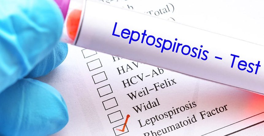 Salud Pública reporta 11 nuevos casos de leptospirosis en la última semana de octubre